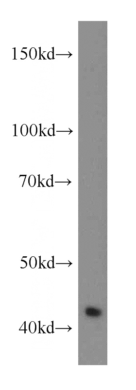 human heart tissue were subjected to SDS PAGE followed by western blot with Catalog No:114648(RGS5 antibody) at dilution of 1:400