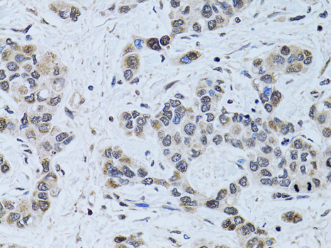 Immunohistochemistry - SIN3A Polyclonal Antibody 