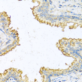 Immunohistochemistry - RNASE13 Polyclonal Antibody 