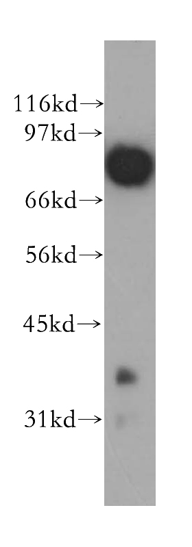 human brain tissue were subjected to SDS PAGE followed by western blot with Catalog No:108042(APPL1 antibody) at dilution of 1:500