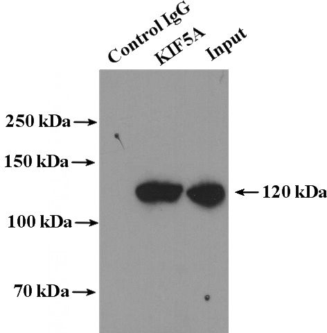 IP Result of anti-KIF5A (IP:Catalog No:112016, 4ug; Detection:Catalog No:112016 1:2000) with mouse brain tissue lysate 4000ug.