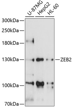 Western blot - ZEB2 Polyclonal Antibody 
