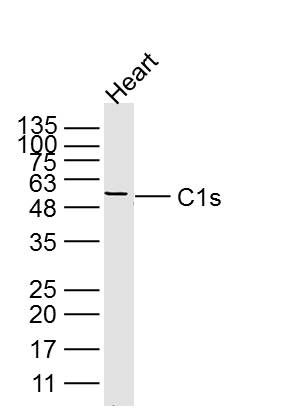Fig2: Sample: Heart (Mouse) Lysate at 40 ug; Primary: Anti-C1s at 1/300 dilution; Secondary: IRDye800CW Goat Anti-Rabbit IgG at 1/20000 dilution; Predicted band size: 47/75 kD; Observed band size: 55 kD