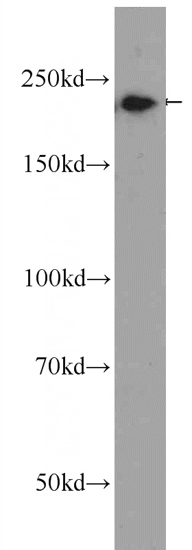 A431 cells were subjected to SDS PAGE followed by western blot with Catalog No:110338(EVPL Antibody) at dilution of 1:300
