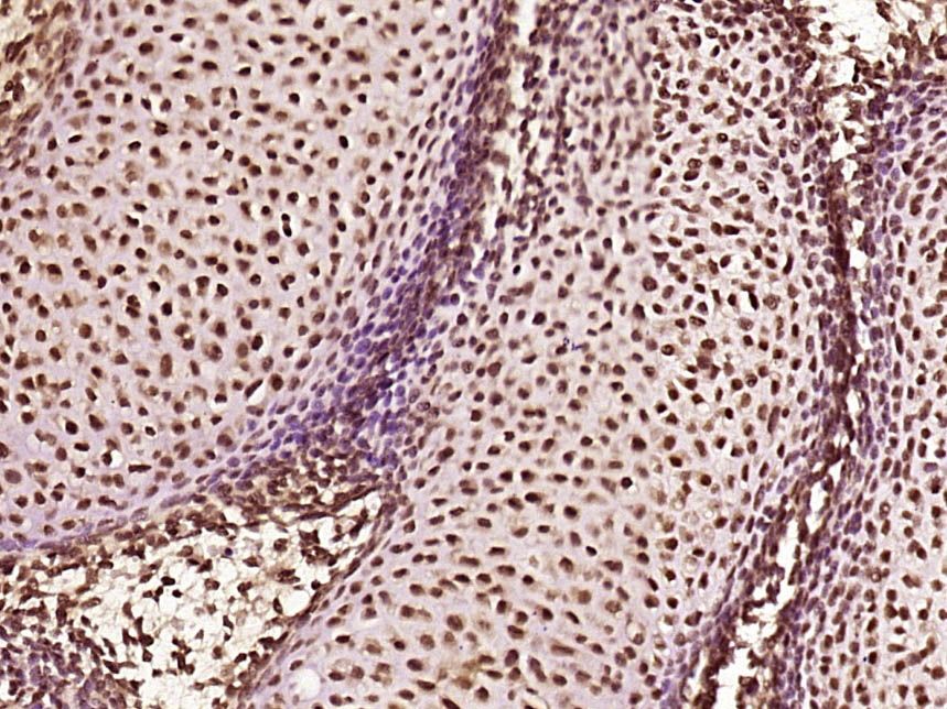 Fig4: Paraformaldehyde-fixed, paraffin embedded (Mouse embryos); Antigen retrieval by boiling in sodium citrate buffer (pH6.0) for 15min; Block endogenous peroxidase by 3% hydrogen peroxide for 20 minutes; Blocking buffer (normal goat serum) at 37℃ for 30min; Antibody incubation with (ZNF312) Polyclonal Antibody, Unconjugated at 1:500 overnight at 4℃, followed by a conjugated secondary (sp-0023) for 20 minutes and DAB staining.