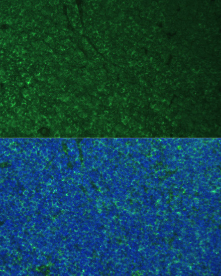 Immunofluorescence - PMAIP1 Polyclonal Antibody 