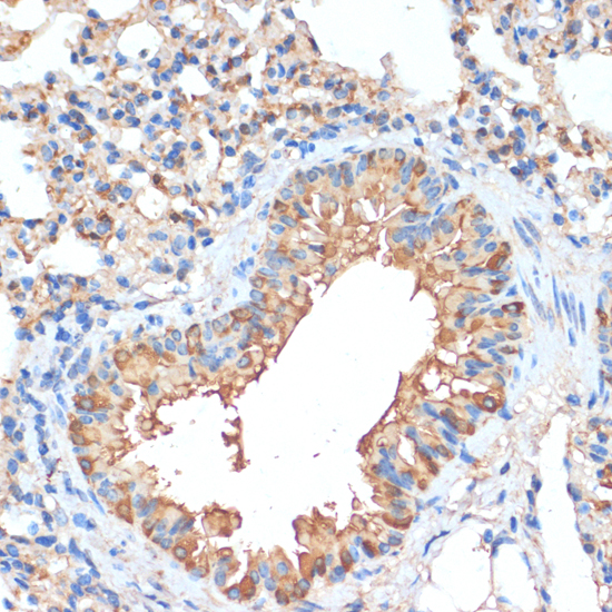 Immunohistochemistry - HHLA2 Polyclonal Antibody 