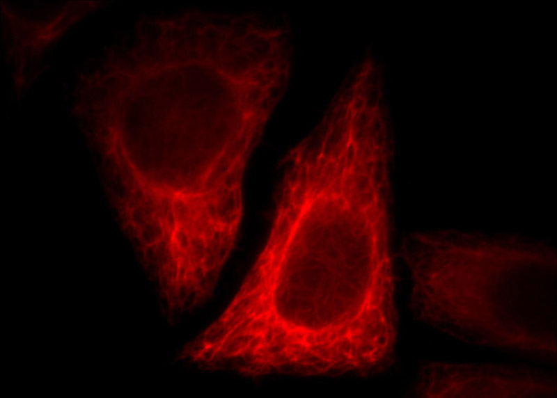 Immunofluorescent analysis of HepG2 cells, using AZIN1 antibody Catalog No:108108 at 1:25 dilution and Rhodamine-labeled goat anti-rabbit IgG (red).