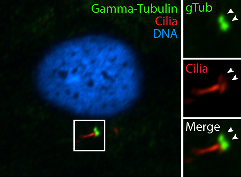 IF results of gamma tubulin antibody (Catalog No:110859, 1:100) with hTERT-RPE cells by Moshe Kim (laboratory of Dr. William S Trimble, University of Toronto). Cells were fixed in ice-cold methanol.
