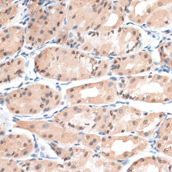 Immunohistochemistry - AQR Polyclonal Antibody 