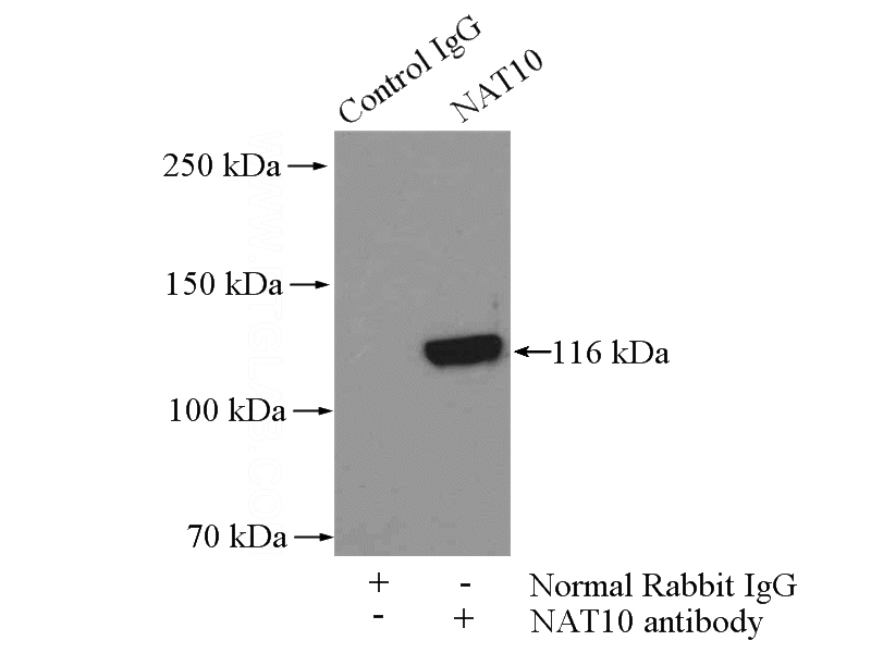 IP Result of anti-NAT10 (IP:Catalog No:112961, 2ug; Detection:Catalog No:112961 1:500) with mouse testis tissue lysate 4000ug.