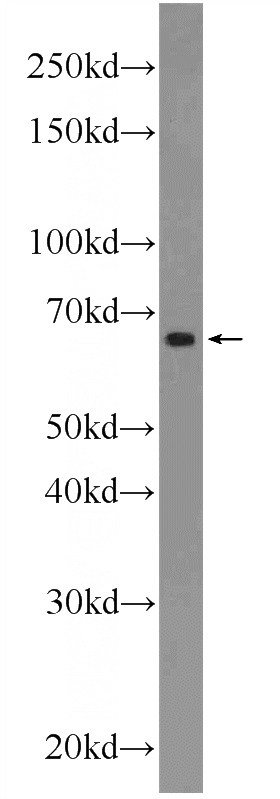 A549 cells were subjected to SDS PAGE followed by western blot with Catalog No:108635(C10orf68 Antibody) at dilution of 1:600