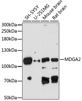 Western blot - MDGA2 Polyclonal Antibody 