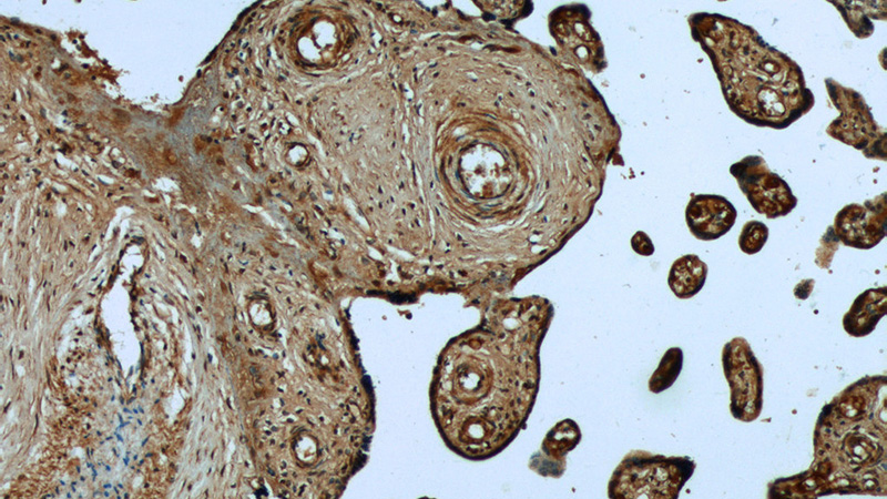 Immunohistochemistry of paraffin-embedded human placenta tissue slide using Catalog No:116679(UCN2 Antibody) at dilution of 1:50 (under 10x lens)