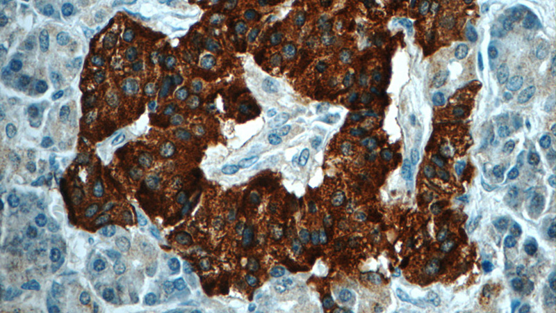 Immunohistochemistry of paraffin-embedded human pancreas tissue slide using Catalog No:114441(RAB3B Antibody) at dilution of 1:50 (under 40x lens)