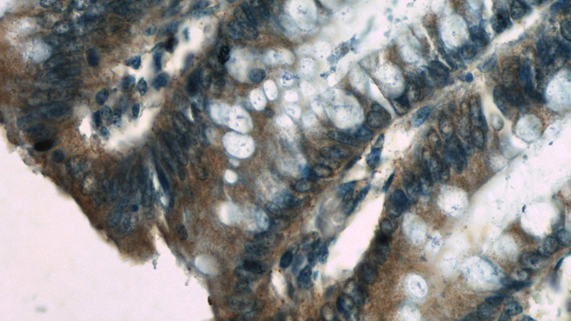 Immunohistochemistry of paraffin-embedded human colon slide using Catalog No:116018(TGFA Antibody) at dilution of 1:50