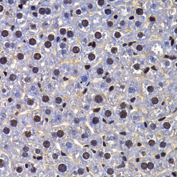 Immunohistochemistry - FIP1L1 Polyclonal Antibody 