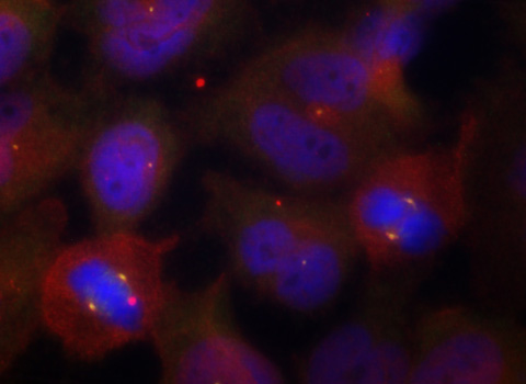 Immunofluorescence - Phospho-SYT2-T202 pAb 