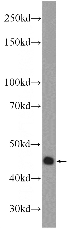 HeLa cells were subjected to SDS PAGE followed by western blot with Catalog No:108551(BUB1 Antibody) at dilution of 1:600