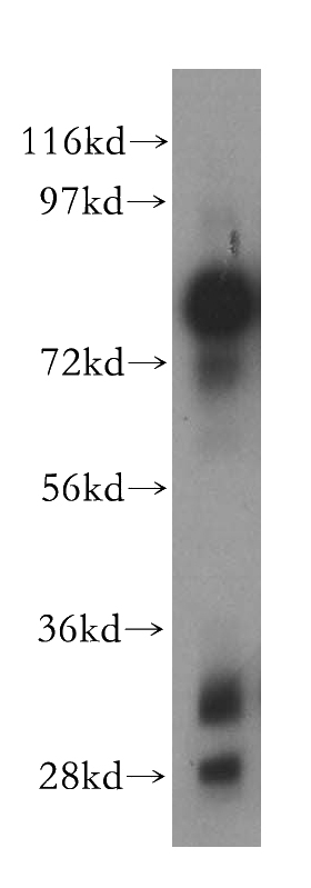 HEK-293 cells were subjected to SDS PAGE followed by western blot with Catalog No:107881(ALPL antibody) at dilution of 1:1000