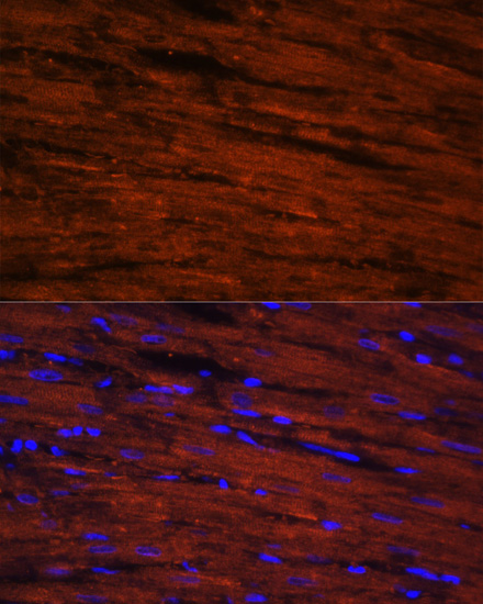 Immunofluorescence - LDB3 Polyclonal Antibody 