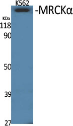 Fig1:; Western Blot analysis of various cells using MRCKα Polyclonal Antibody