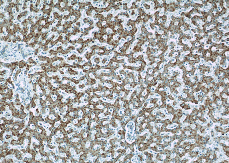 Immunohistochemical of paraffin-embedded human liver using Catalog No:111788(INE1 antibody) at dilution of 1:50 (under 10x lens)