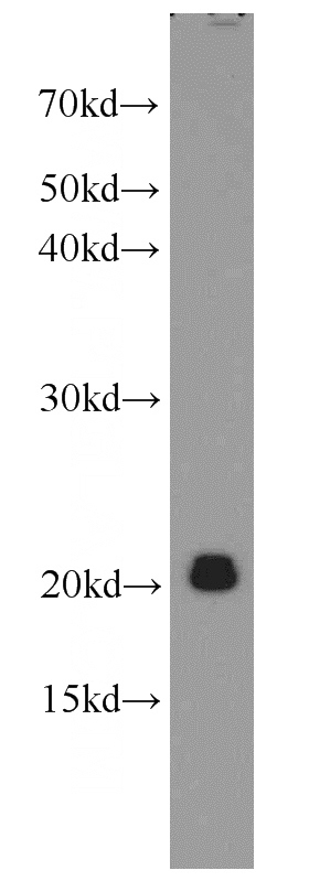 human heart tissue were subjected to SDS PAGE followed by western blot with Catalog No:109857(DAND5 antibody) at dilution of 1:400