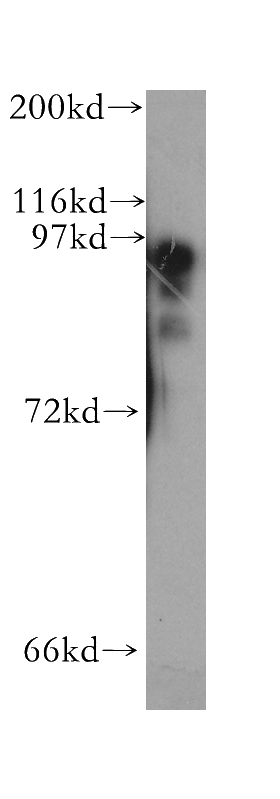 human liver tissue were subjected to SDS PAGE followed by western blot with Catalog No:113854(PKD2L1 antibody) at dilution of 1:500