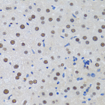 Immunohistochemistry - MTA3 Polyclonal Antibody 
