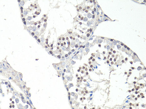 Immunohistochemistry - FTO Polyclonal Antibody 