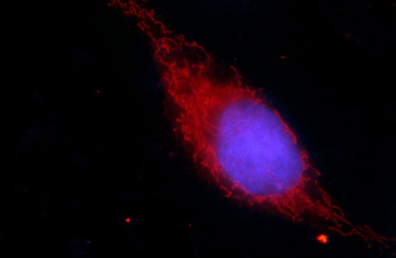 Immunofluorescent analysis of HepG2 cells using Catalog No:107509(RPL3 Antibody) at dilution of 1:50 and Rhodamine-Goat anti-Mouse IgG