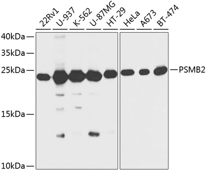 Western blot - PSMB2 Polyclonal Antibody 
