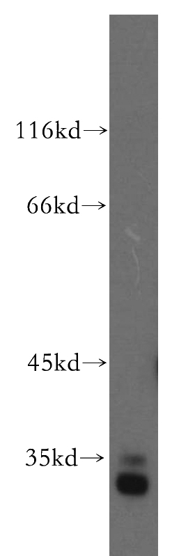 human kidney tissue were subjected to SDS PAGE followed by western blot with Catalog No:109738(CUEDC2 antibody) at dilution of 1:300