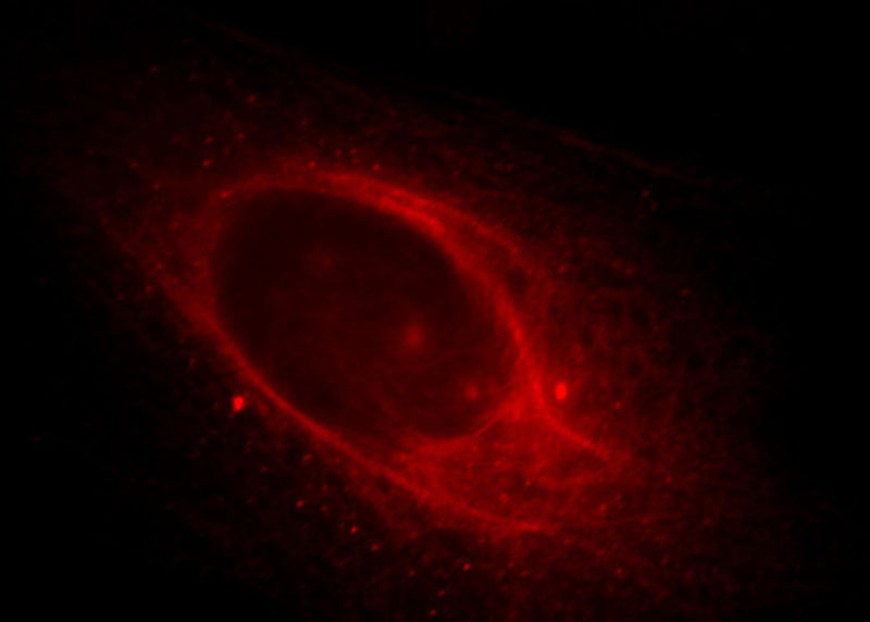 Immunofluorescent analysis of Hela cells, using C16orf14 antibody Catalog No:108604 at 1:25 dilution and Rhodamine-labeled goat anti-rabbit IgG (red).