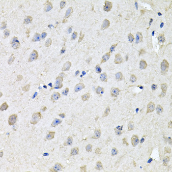 Immunohistochemistry - CHCHD3 Polyclonal Antibody 
