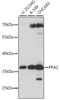 Western blot - PPA2 Polyclonal Antibody 