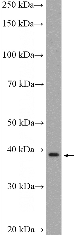 HeLa cells were subjected to SDS PAGE followed by western blot with Catalog No:108070(ANKRD16 Antibody) at dilution of 1:600
