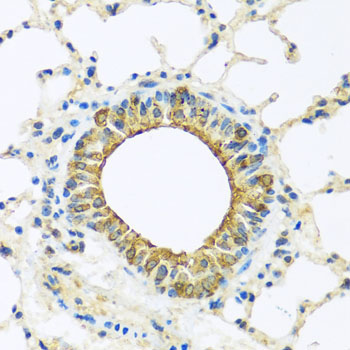 Immunohistochemistry - DCP2 Polyclonal Antibody 
