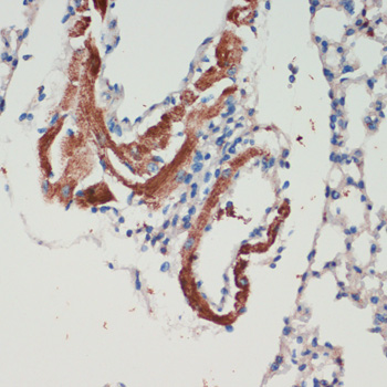 Immunohistochemistry - LRRK2 Polyclonal Antibody 