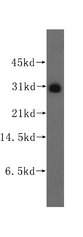 human lung tissue were subjected to SDS PAGE followed by western blot with Catalog No:110680(FKBP7 antibody) at dilution of 1:500