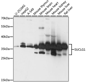 Western blot - SUCLG1 Polyclonal Antibody 