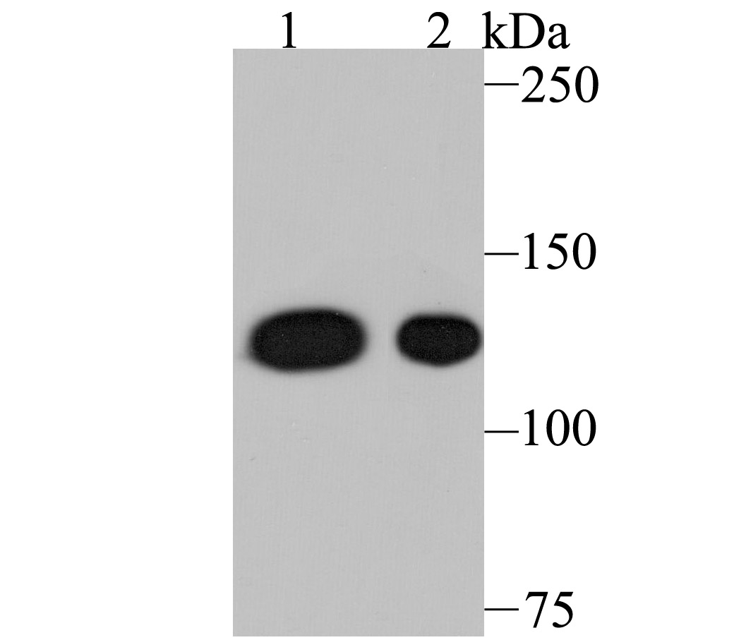 Fig1: Western blot analysis of Nesprin 1 on different lysates using anti-Nesprin 1 antibody at 1/500 dilution.; Positive control:; Lane 1: A549; Lane 2: Mouse spleen tissue