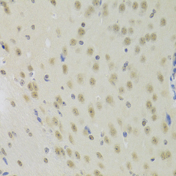 Immunohistochemistry - PRPF3 Polyclonal Antibody 
