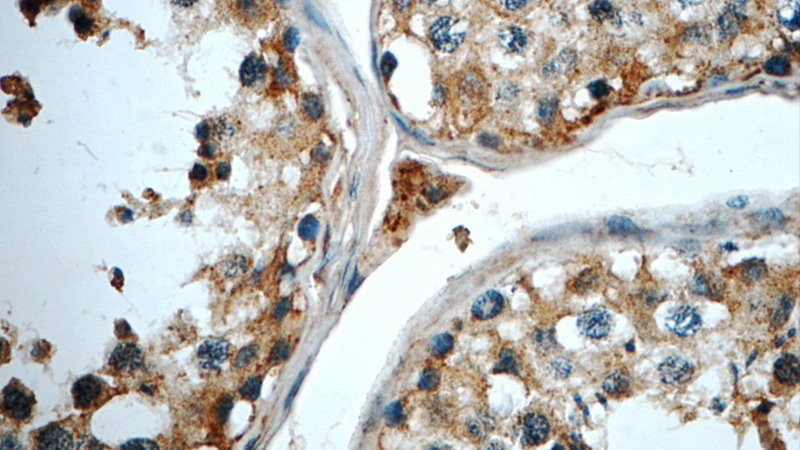Immunohistochemistry of paraffin-embedded human testis tissue slide using Catalog No:109588(CRY1 Antibody) at dilution of 1:50 (under 40x lens)
