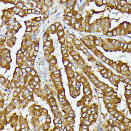 Immunohistochemistry - COX15 Polyclonal Antibody 