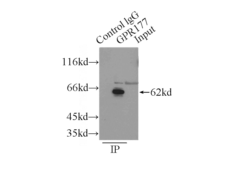 IP Result of anti-GPR177 (IP:Catalog No:111120, 3ug; Detection:Catalog No:111120 1:500) with mouse liver tissue lysate 12500ug.
