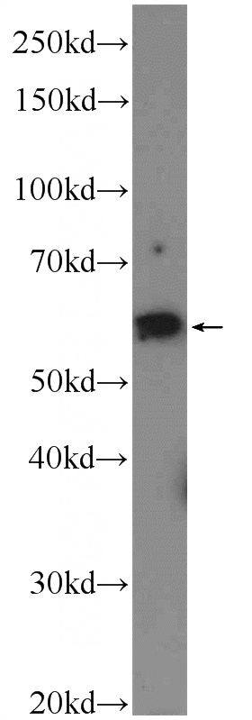 rat skeletal muscle tissue were subjected to SDS PAGE followed by western blot with Catalog No:109477(CORO6 Antibody) at dilution of 1:600