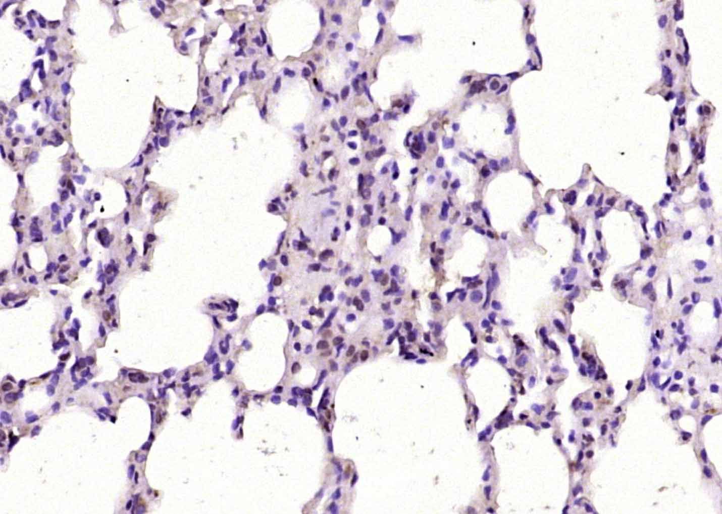 Fig3: Paraformaldehyde-fixed, paraffin embedded (rat lung); Antigen retrieval by boiling in sodium citrate buffer (pH6.0) for 15min; Block endogenous peroxidase by 3% hydrogen peroxide for 20 minutes; Blocking buffer (normal goat serum) at 37℃ for 30min; Antibody incubation with (ZNF144) Polyclonal Antibody, Unconjugated at 1:200 overnight at 4℃, followed by operating according to SP Kit(Rabbit) (sp-0023) instructionsand DAB staining.