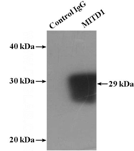 IP Result of anti-MITD1 (IP:Catalog No:112660, 4ug; Detection:Catalog No:112660 1:500) with HeLa cells lysate 1080ug.